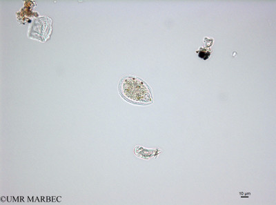 phyto/French_Polynesia/Tahiti_Ifremer/PHYTOCONT June 2015/Ostreopsis ovata (ancien Prorocentrum sp3 -ancien cf Oodinium sp-150824_001_ovl-2).tif(copy)_thumb.jpg